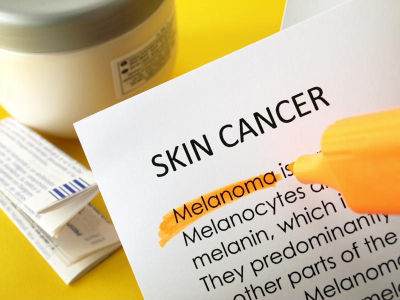 Regular skin checks can help seniors avoid skin cancer.